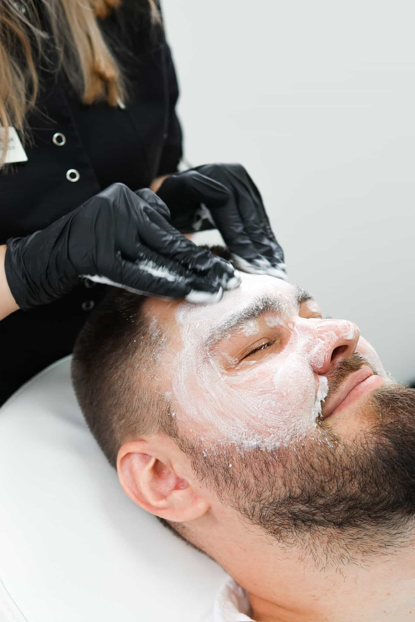 Obagi Blue Peel Radiance Peel for Skin Rebalancing in Kingston Upon Thames Surrey London